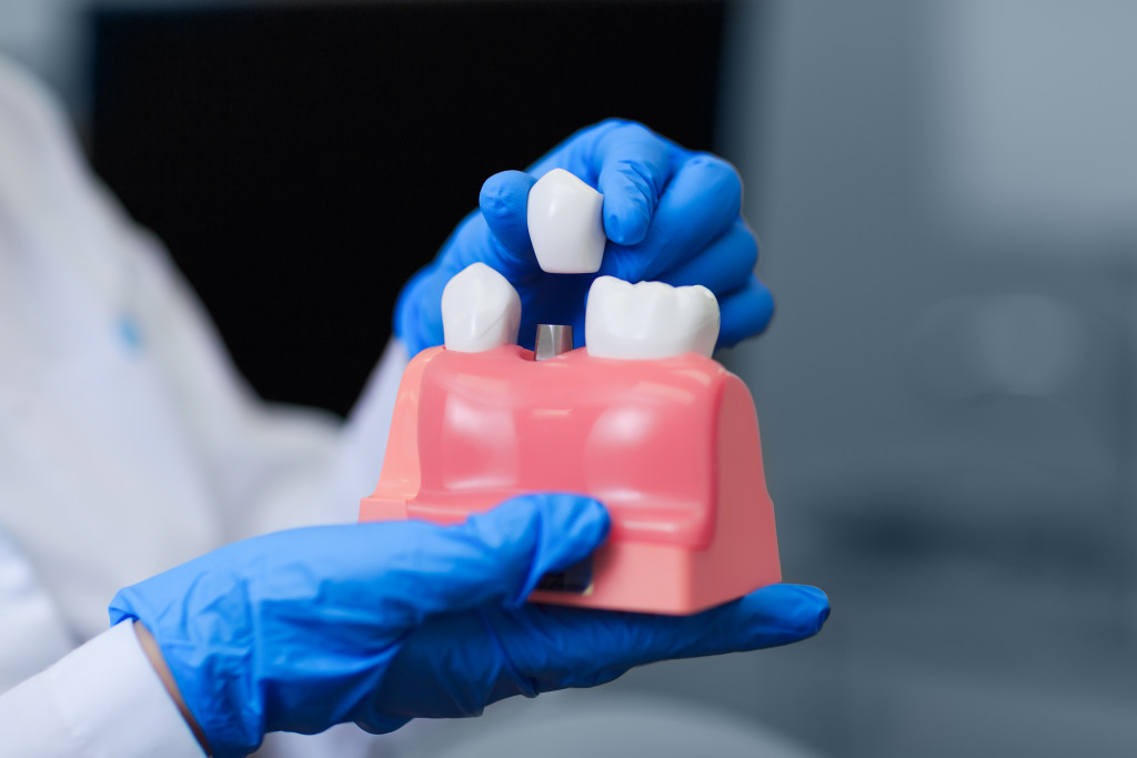 dental implant in tooth model